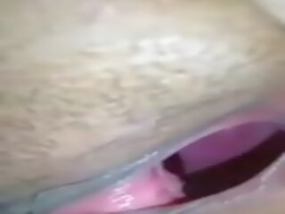 Fittor stänga upp (inside utsikt av vaginaen)